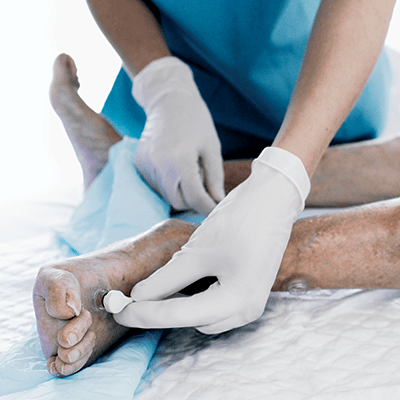 Webinar transcutaneous oxygen monitoring of hyperbaric problem wound referrals